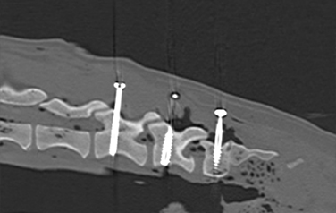 Lumbosacral disease